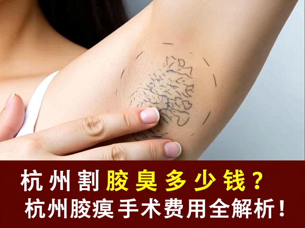 杭州割腋臭多少钱？杭州腋臭手术费用全解析！