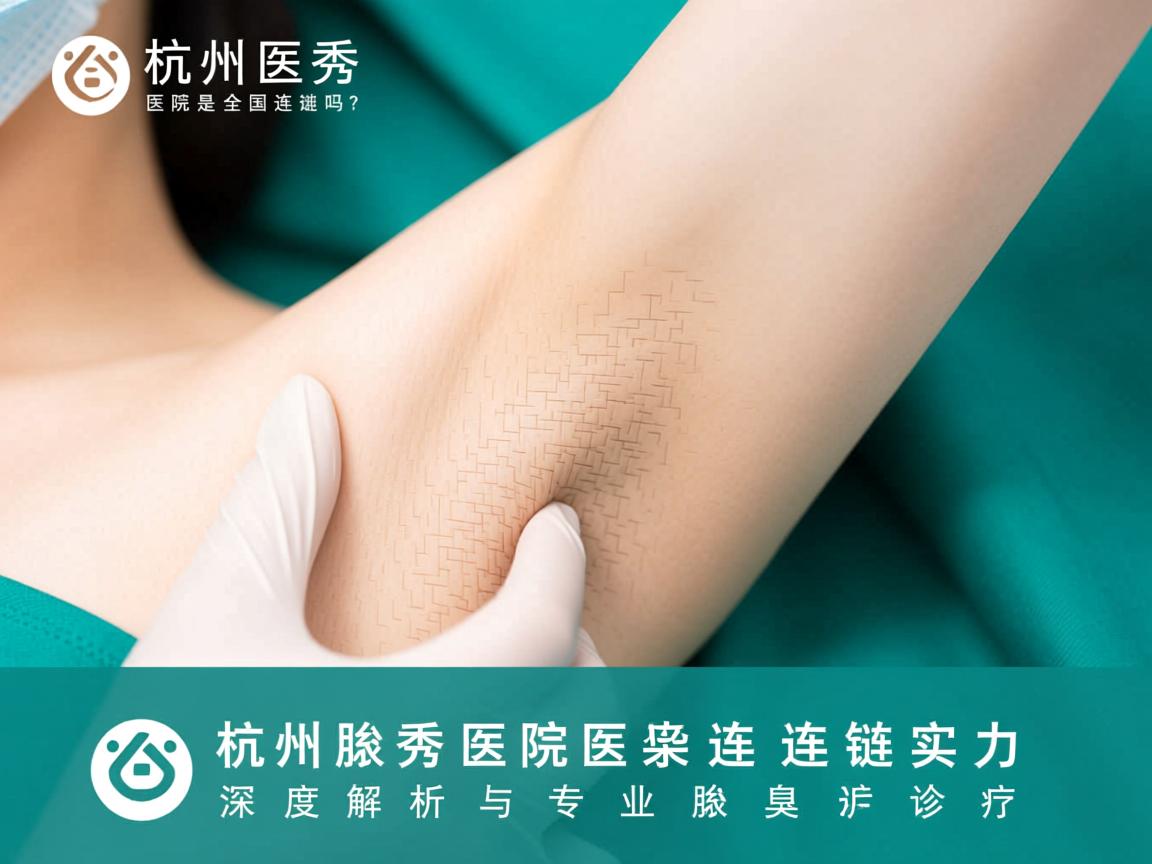 杭州腋秀医院是全国连锁吗？深度解析腋秀医院的连锁实力与专业腋臭诊疗