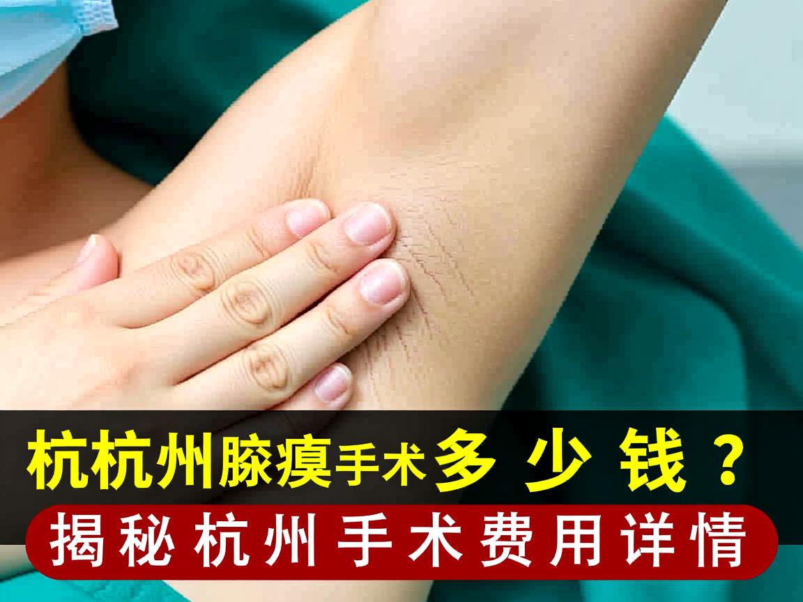 杭州腋臭手术多少钱？揭秘杭州腋臭手术费用详情