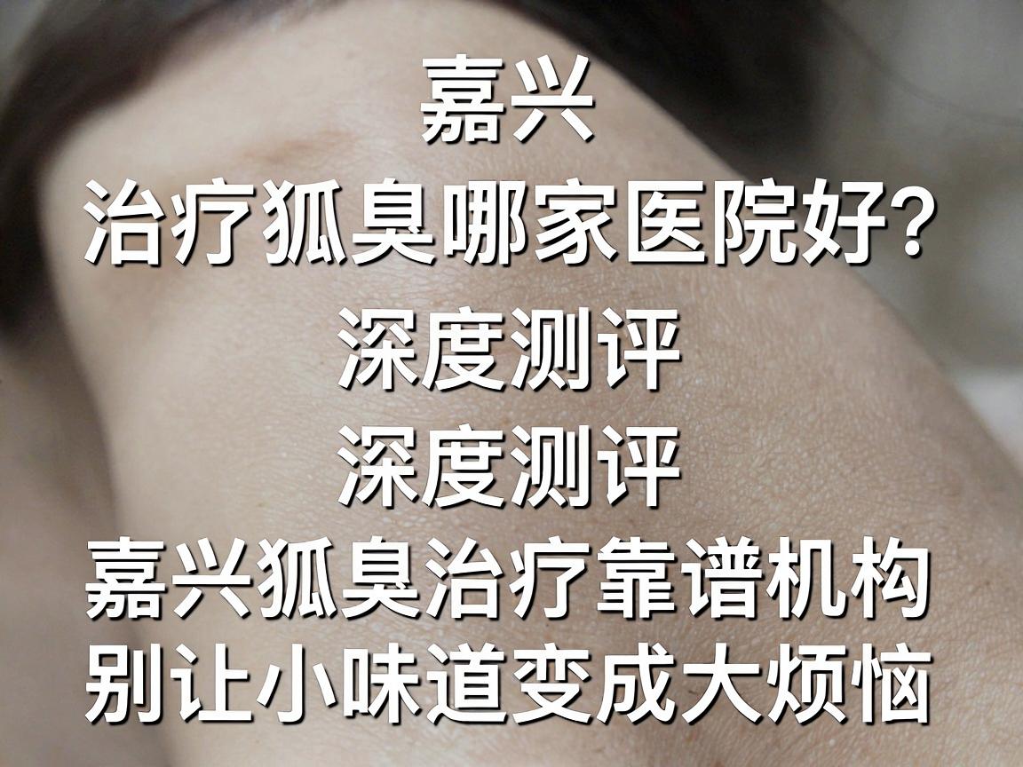 嘉兴治疗狐臭哪家医院好?深度测评嘉兴狐臭治疗靠谱机构,别让小味道变成大烦恼 嘉兴治疗狐臭哪家医院好?深度测评嘉兴狐臭治疗靠谱机构,别让小味道变成大烦恼