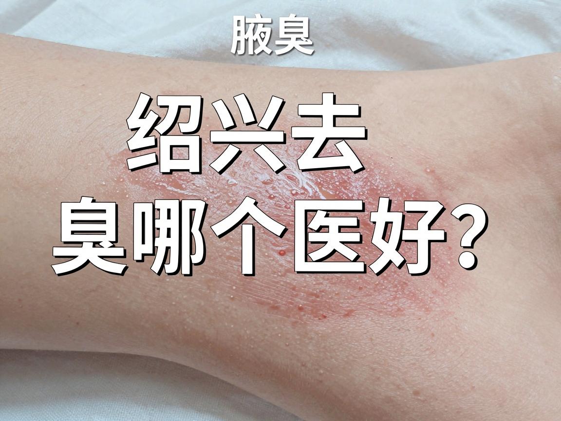 绍兴去腋臭哪个医院好？选对医院，腋臭问题才能根除