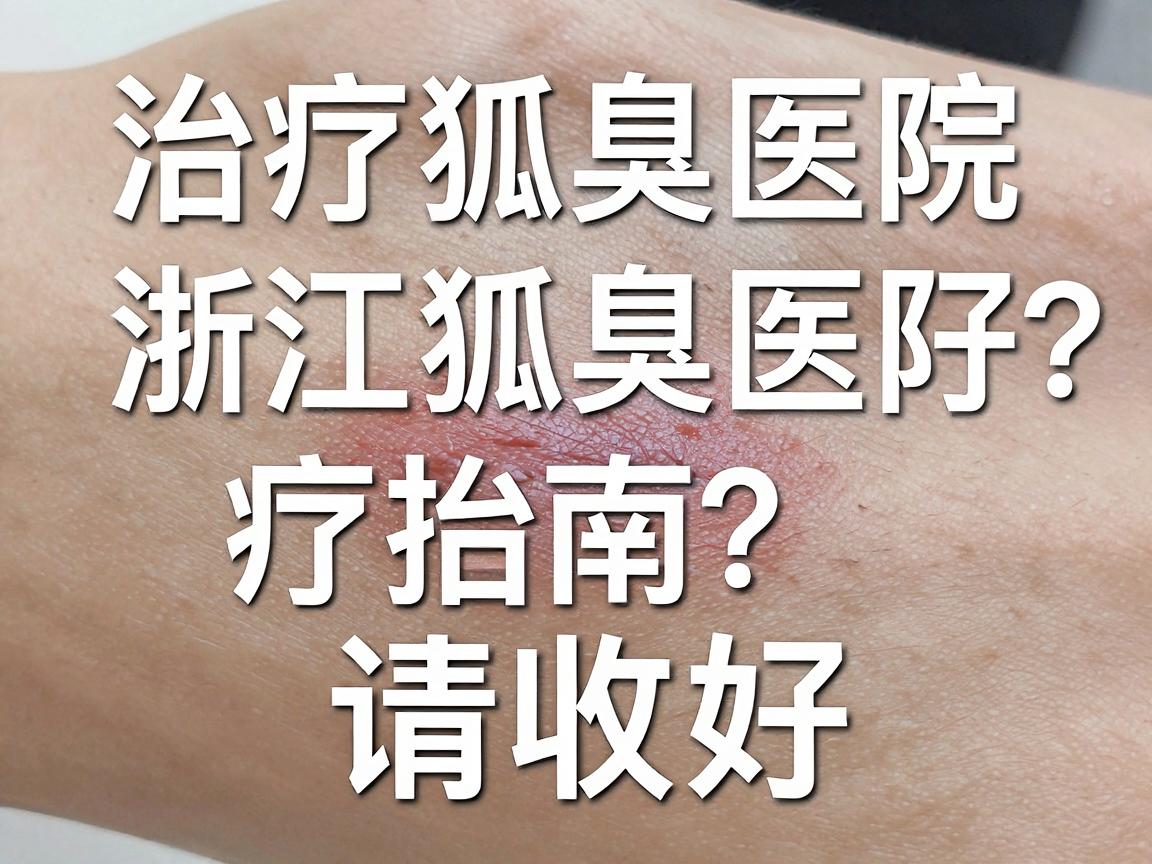 治疗狐臭浙江最好的医院怎么选？浙江狐臭医院治疗指南请收好