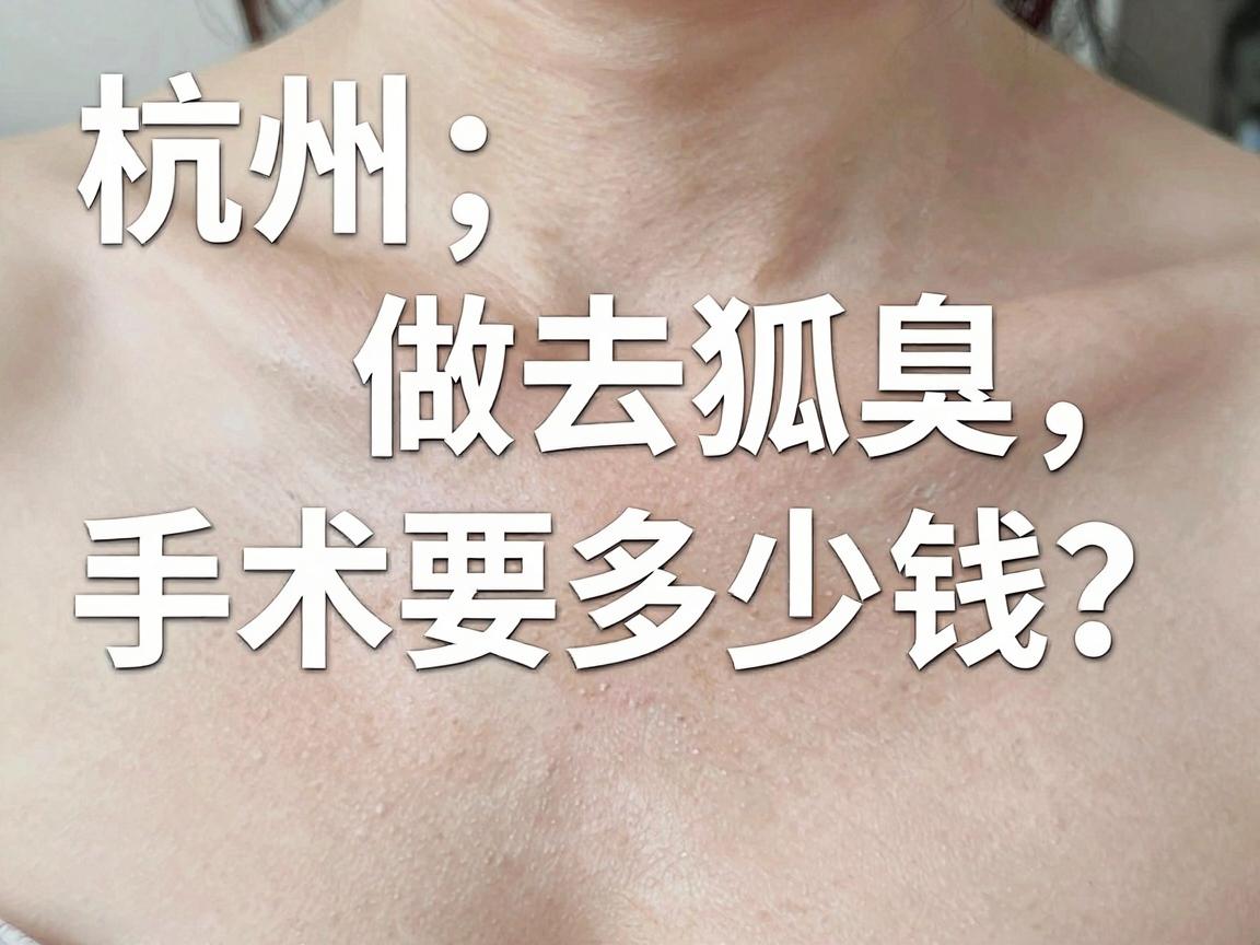 杭州做去狐臭手术要多少钱？一文说清杭州去狐臭手术的价位与价值