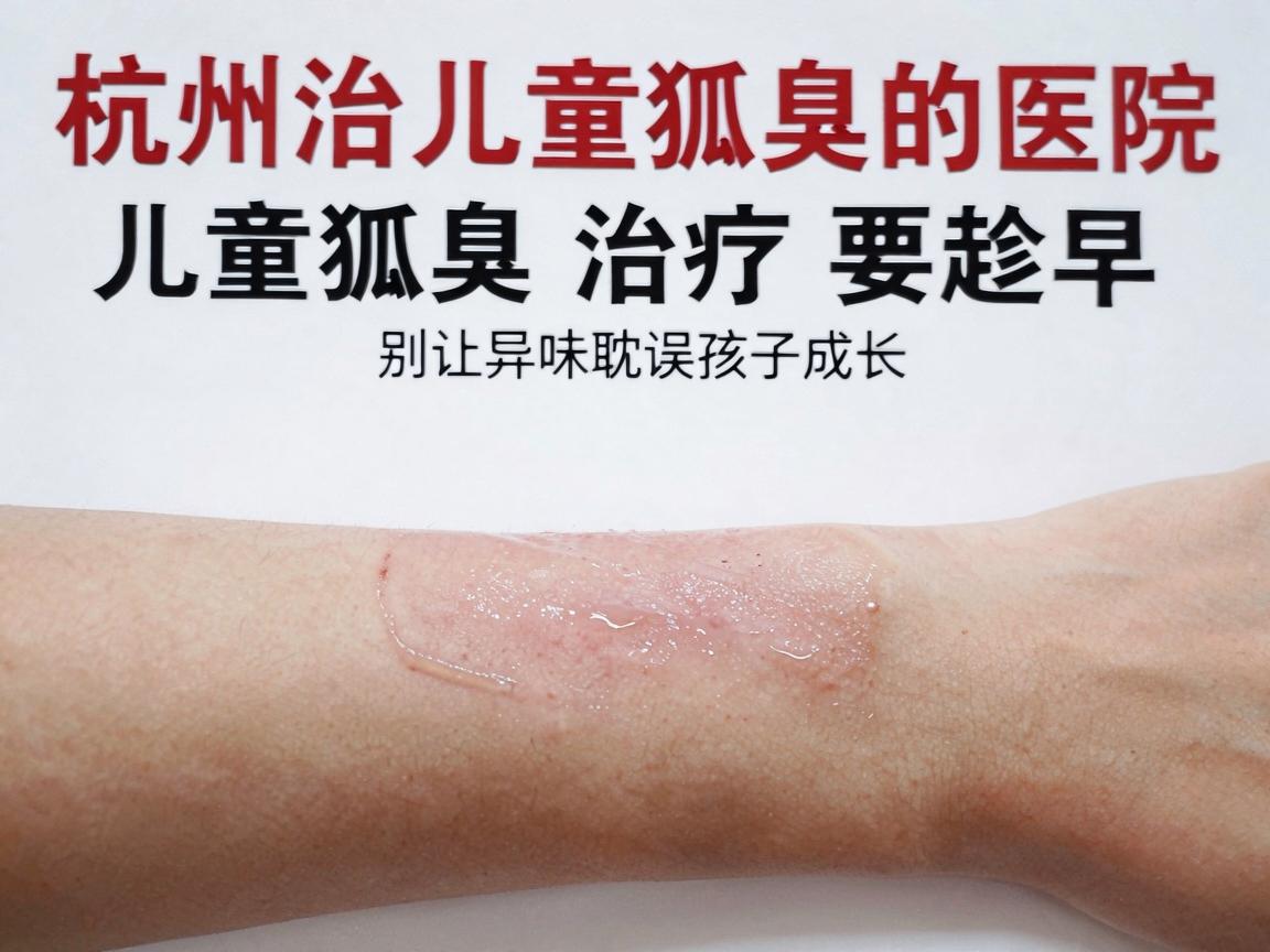 杭州治儿童狐臭的医院，儿童狐臭治疗要趁早，别让异味耽误孩子成长