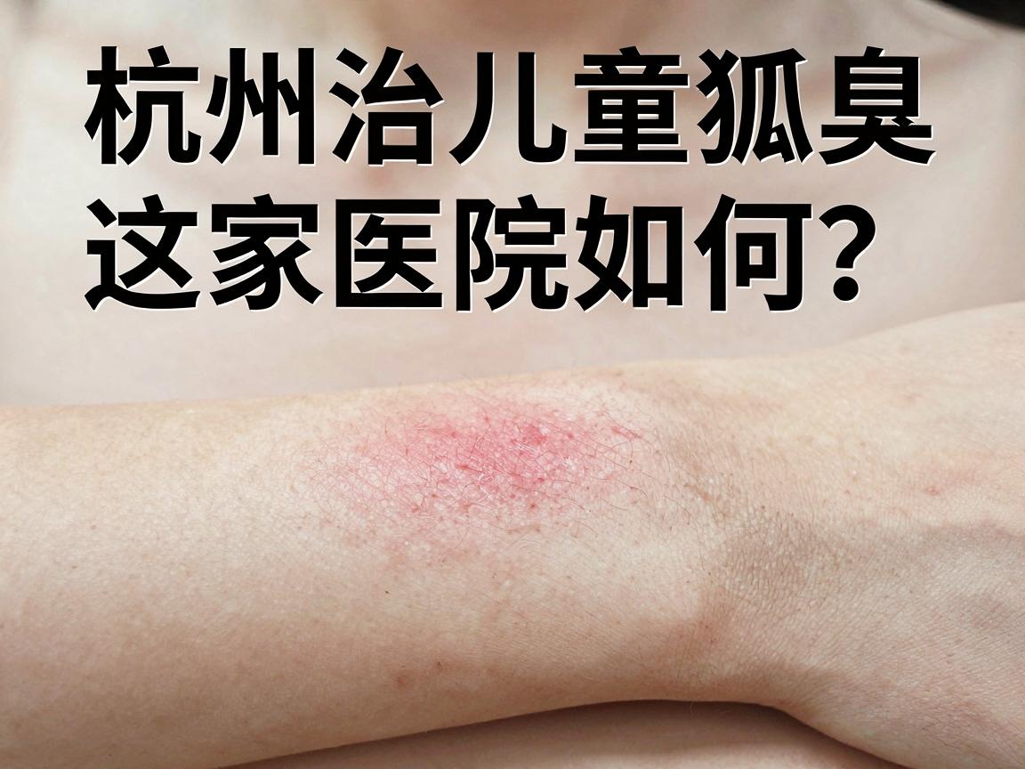 杭州治儿童狐臭，这家医院如何？杭州儿童狐臭治疗须知