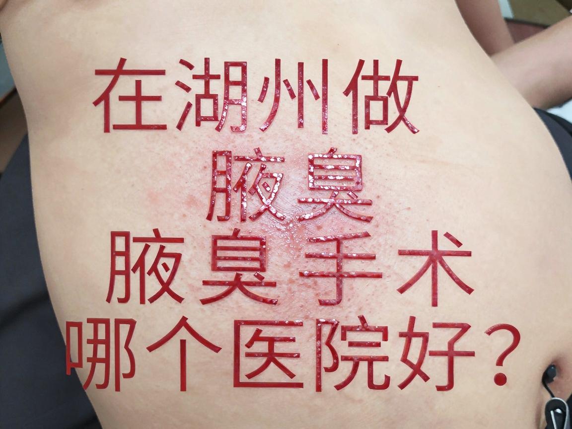 在湖州做腋臭手术哪个医院好？湖州腋臭治疗医院选择攻略