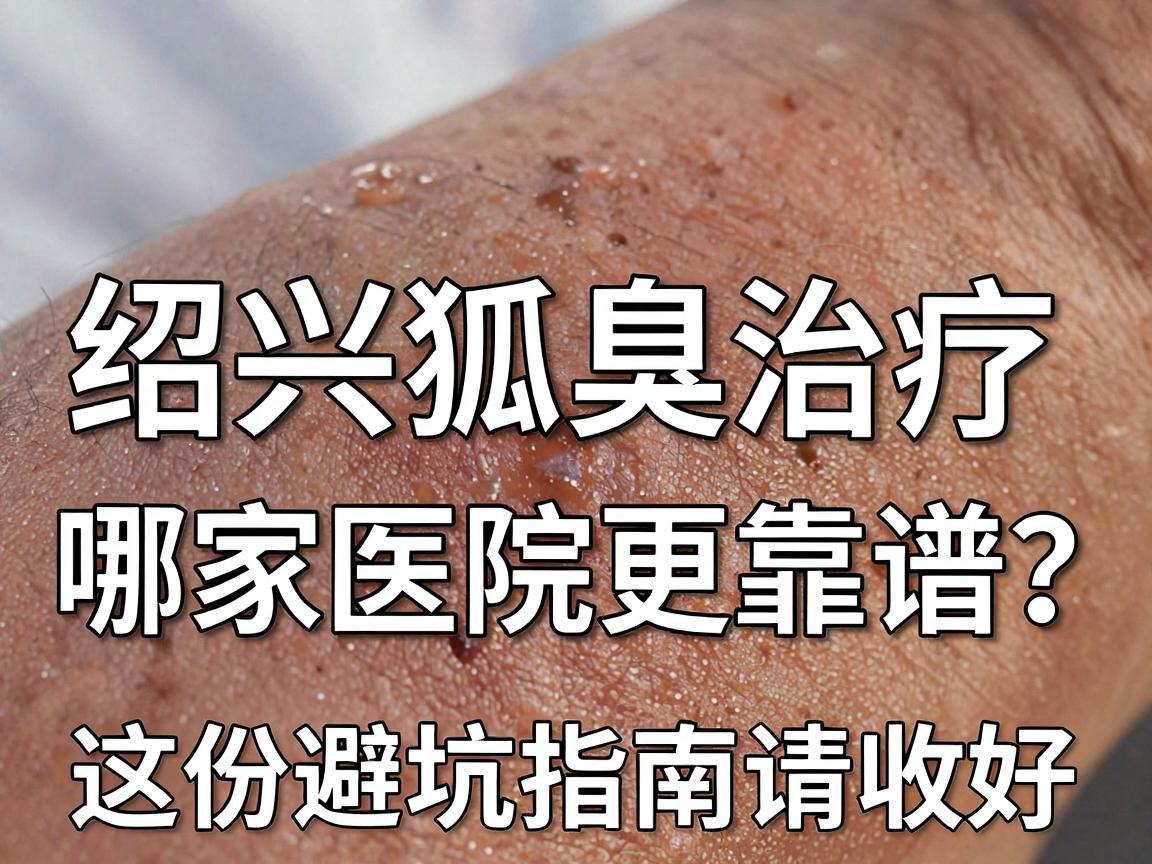 绍兴狐臭医院怎么选?绍兴狐臭治疗哪家医院更靠谱?这份避坑指南请收好 绍兴狐臭医院怎么选?绍兴狐臭治疗哪家医院更靠谱?这份避坑指南请收好