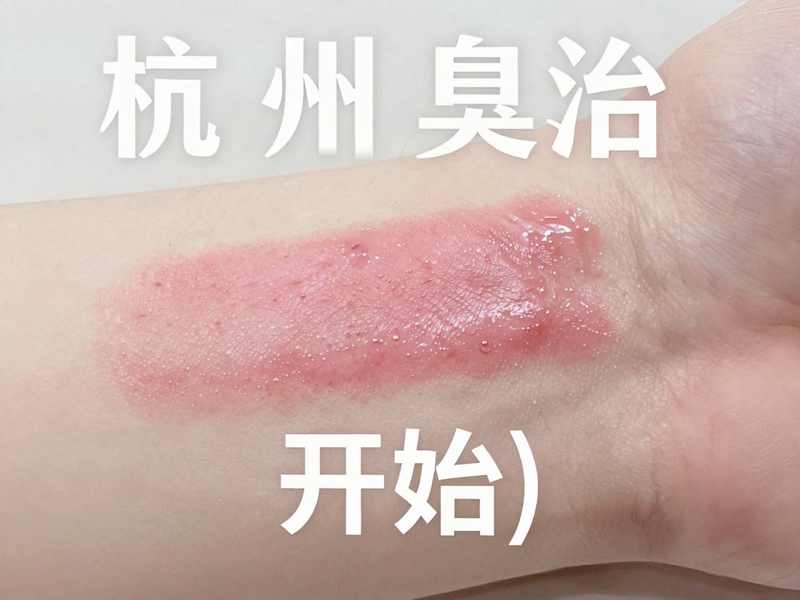 杭州腋臭治疗医院怎么选？选对腋臭医院，告别腋臭困扰
开始）