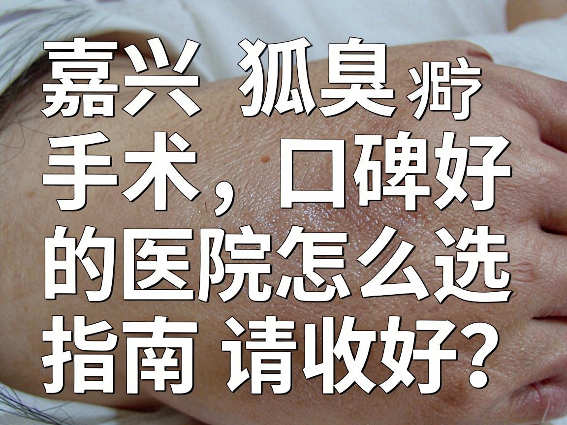 嘉兴狐臭手术口碑好的医院怎么选?这份嘉兴腋臭治疗避坑指南请收好 嘉兴狐臭手术口碑好的医院怎么选?这份嘉兴腋臭治疗避坑指南请收好