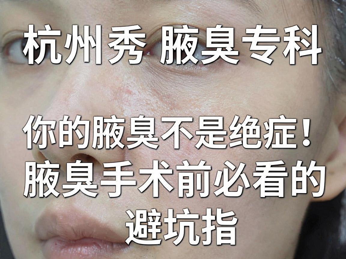 杭州腋秀腋臭专科,你的腋臭不是绝症,腋臭手术前必看的三大真相与避坑指南 杭州腋秀腋臭专科,你的腋臭不是绝症,腋臭手术前必看的三大真相与避坑指南
