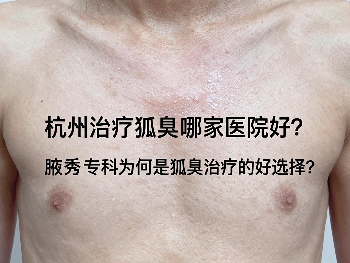 杭州治疗狐臭哪家医院好?腋秀专科为何是杭州狐臭治疗的好选择? 杭州治疗狐臭哪家医院好?腋秀专科为何是杭州狐臭治疗的好选择?