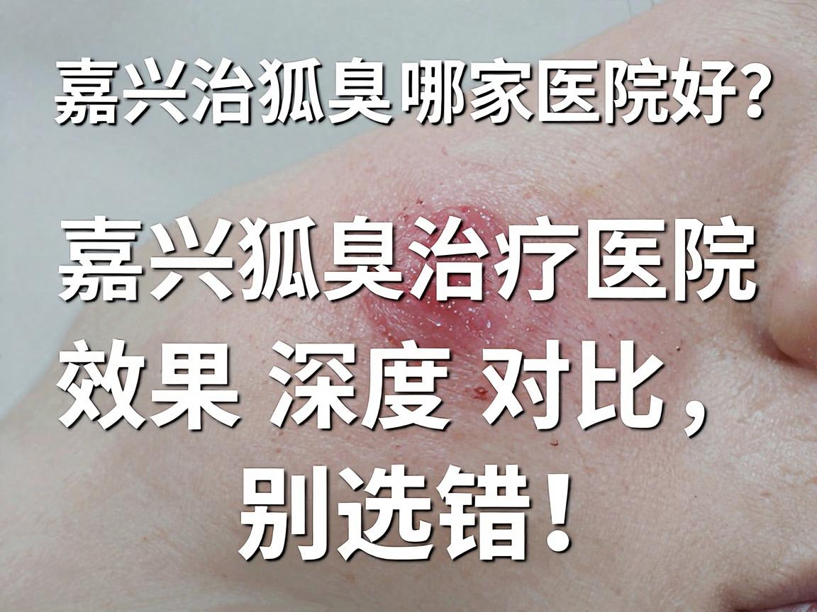 嘉兴治狐臭哪家医院好?嘉兴狐臭治疗医院效果深度对比,别选错! 嘉兴治狐臭哪家医院好?嘉兴狐臭治疗医院效果深度对比,别选错!