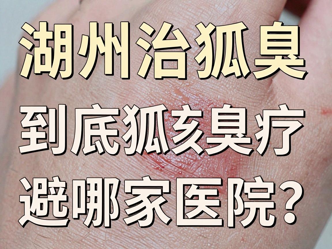 湖州治狐臭,到底该选哪家医院?湖州狐臭治疗医院避坑指南 湖州治狐臭,到底该选哪家医院?湖州狐臭治疗医院避坑指南