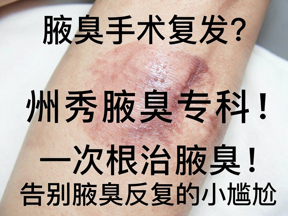 腋臭手术复发？杭州腋秀腋臭专科，一次根治腋臭，告别腋臭反复的小尴尬